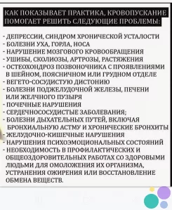 Хиджама, қаналу, кровопускание