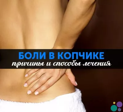 Боль в копчике, кокцигодиния, боли в копчике, лечение копчика