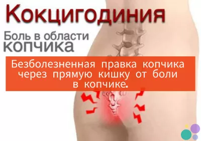 Боль в копчике, кокцигодиния, боли в копчике, лечение копчика