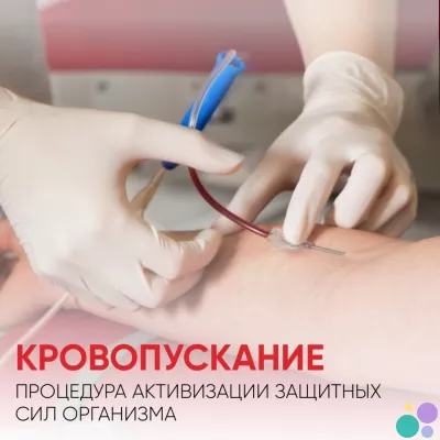 Гемоэксфузия как профилактика тромбоза