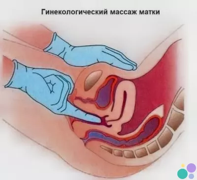 Курсовое лечение опущения матки: гинекологический массаж