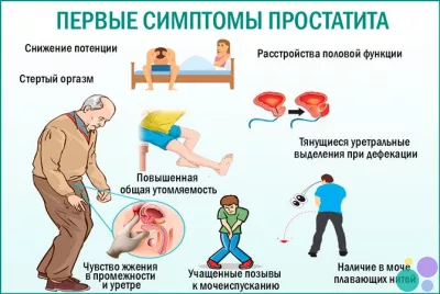 Массаж простаты при атонии. Корректно
